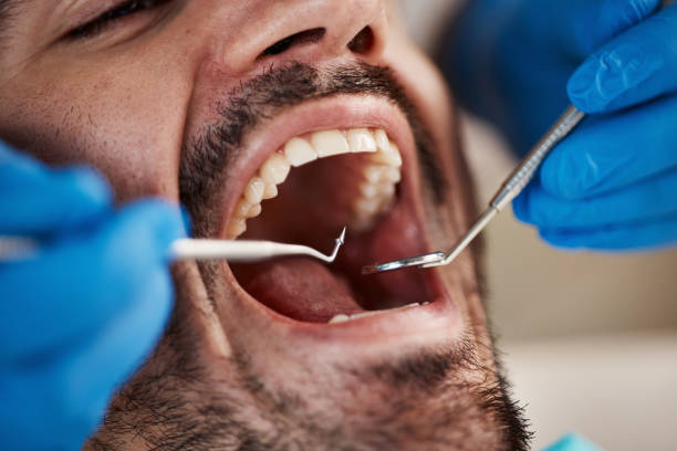 Best Emergency Treatment for Toothache in South Kensington, MD